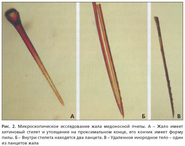 Жало пчелы: фото под микроскопом