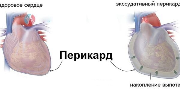 Травматический перикардит у животных: симптомы и терапия